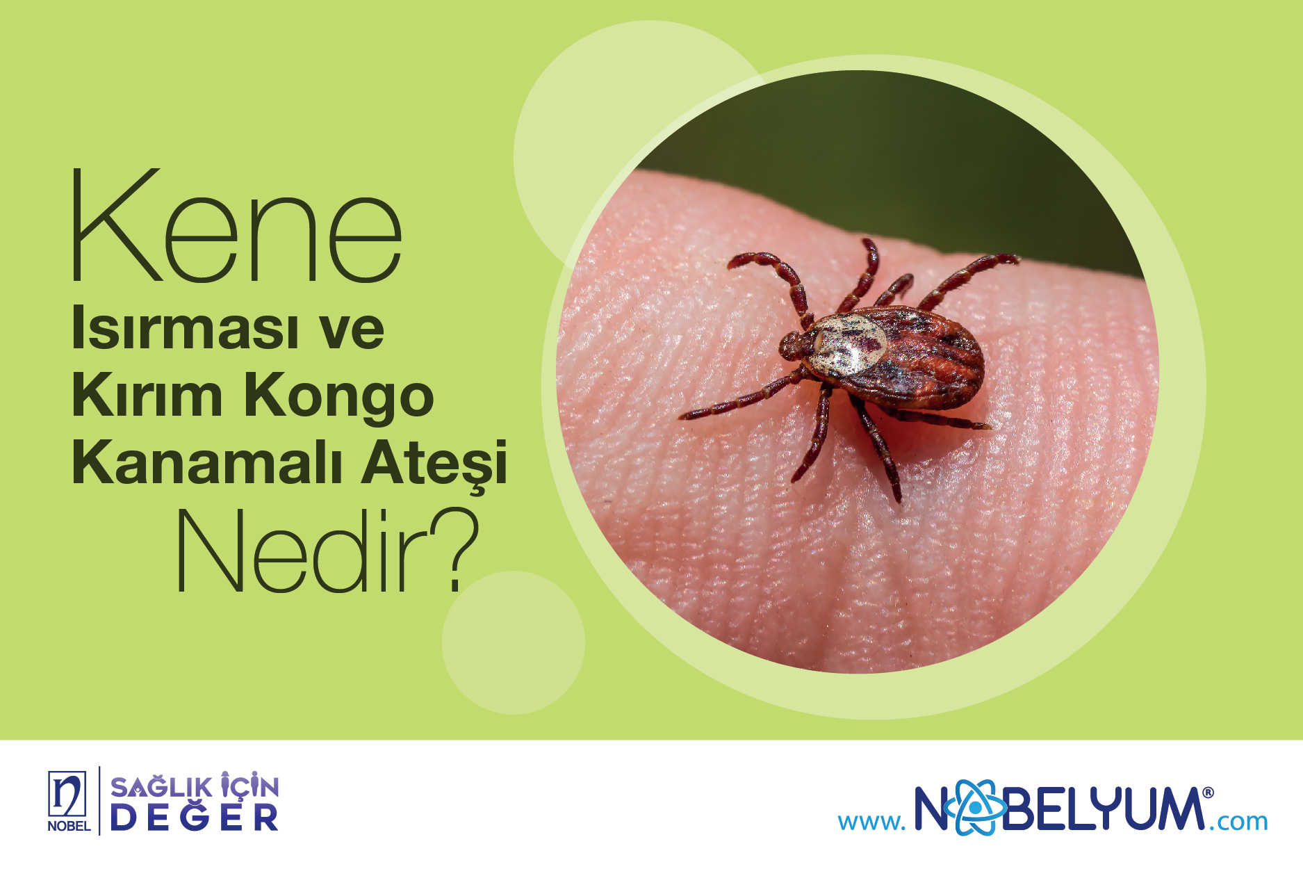 Kene Isırması ve Kırım Kongo Kanamalı Ateşi Nedir? Kene Isırması ve Kırım Kongo Kanamalı Ateşi Nedir?