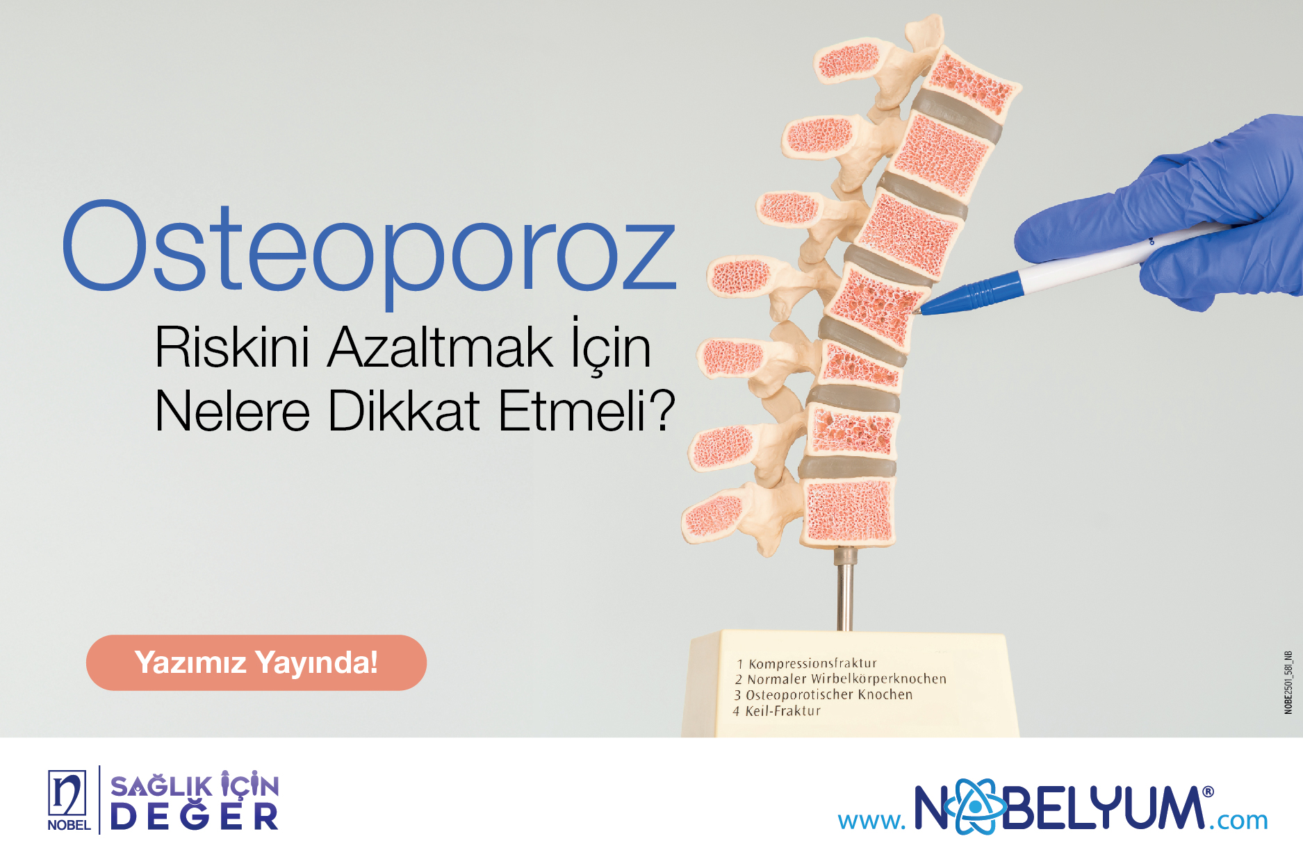 osteoporoz-24032025-guncelgelismeler osteoporoz-24032025-guncelgelismeler